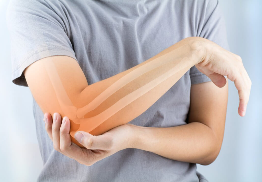 Bone Health